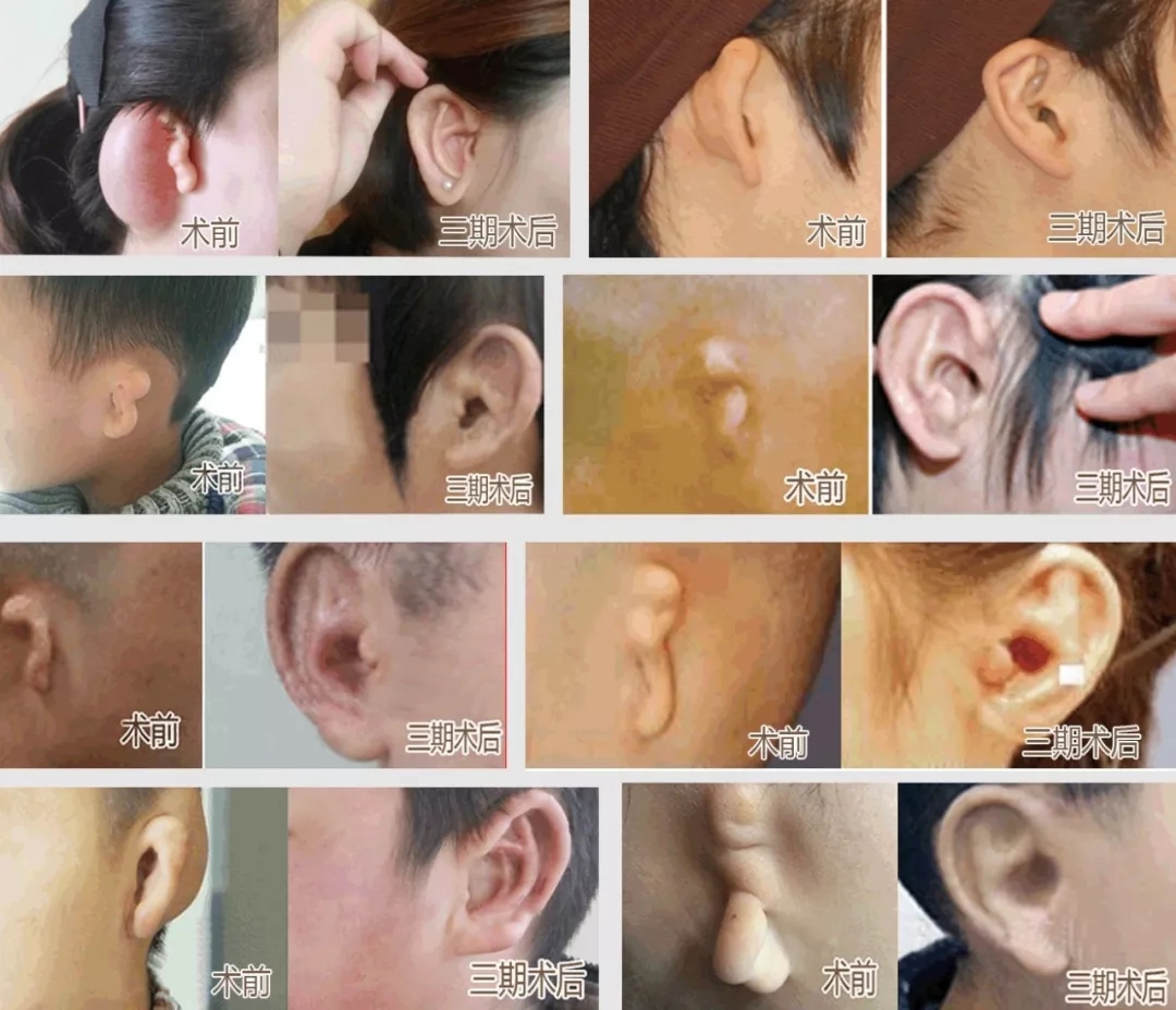 說明: 640.webp (39)